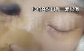 女子头戴鲨鱼夹摔倒后成植物人，男友自责：要结婚了，不会放弃她