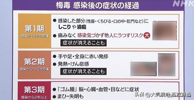 梅毒狂欢？日本年轻人的＂致命浪漫＂究竟有多疯狂？